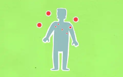 Infektion: infeksiya